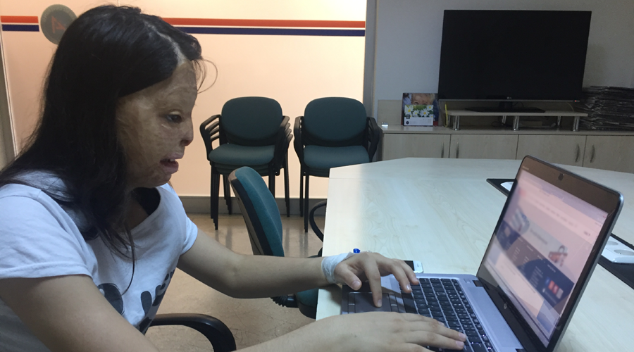 9 aylıkken yüzü yanan Firdevs'in hayali, vali ya da polis olmak