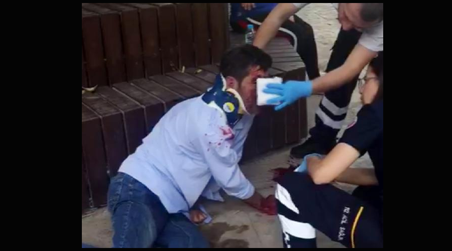Arkadaşının yumruğu ile burnu yırtıldı